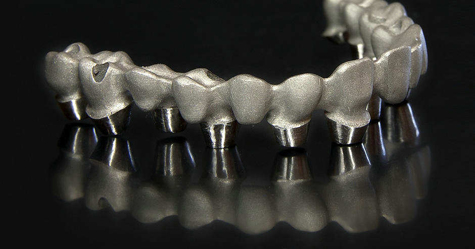 Application of 3D Printing Technology in Medical (Dental)